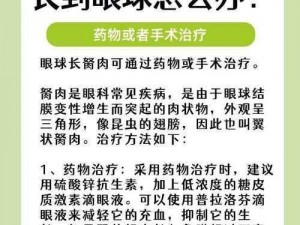 超级胬肉系统——专业治疗胬肉的先进设备