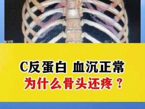 为什么起来还在 c 骨科？这种情况正常吗？