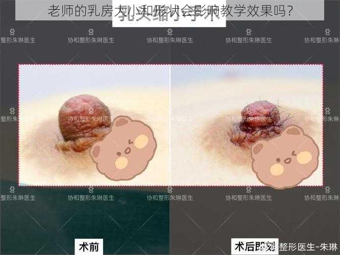 老师的乳房大小和形状会影响教学效果吗？