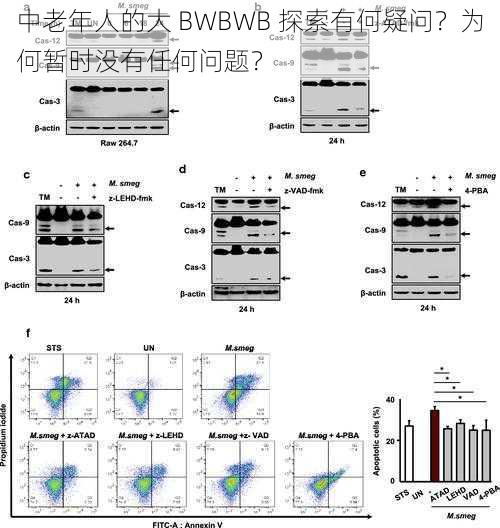 中老年人的大 BWBWB 探索有何疑问？为何暂时没有任何问题？